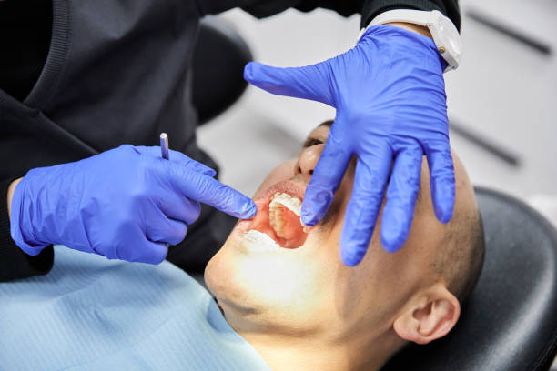 Best Emergency Wisdom Tooth Extraction in Allendale, MI